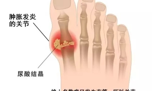 鸡胸肉含脂肪吗-【鸡脯肉热量高吗】鸡脯肉含蛋白质多吗 - 鸡脯肉含脂肪吗网